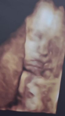 Ultrasonda ekranda renkli insan embriyosu var. Hamile bir kadının ultrasonu. Bilimsel analiz. Annesinin karnında minik bir bebek. Yakın plan. Dikey video