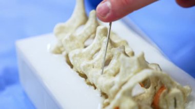 İnce metal alet omurga kuklasında bir deliğe sokulur. Daha sonra vida başlıklı cihaz kullanılıyor. Kapatın. Nöroşirürji bilimi pratiği.