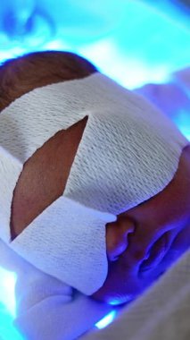 Fototerapi gören güzel bir bebek. Küçük bebek battaniyeyle kaplı beşiğinde bir lambanın üzerinde yatıyor. Üst kat kapanış. Dikey video