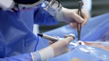 Farlı erkek cerrah elektrikli aletler kullanıyor. Doktor göğüs büyütme ameliyatı yapıyor. Kapat..