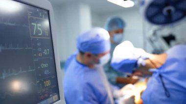 Ciğer ventilatöründe çalışan bazı numaralar var. Erkek cerrahlar, arka planda bulanık çalışırlar..