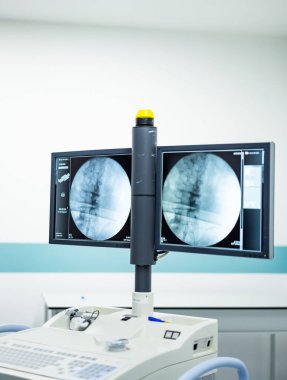 Klinik tıbbi görüntüleme araçları. Yüksek teknolojili görüntüleme ekipmanları bir sağlık tesisinde radyografik görüntüler göstererek hasta teşhislerini vurguluyor..