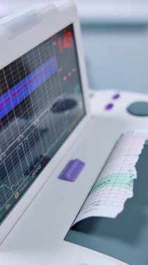Elektrokardiyogram için modern tıbbi ekipman. Araştırma yapmak için kardiyak aparatlar, EKG ve hamilelik sırasında kalbin incelenmesi. Üst görünüm kapalı. Dikey video