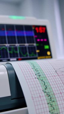 Elektronik kardiyogram baskı kağıdı raporu makinesi. Kapatın. Hamile kadın için kalp muayenesi. Dikey video