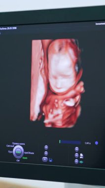 Ultrason cihazında bir bebeğin doğum öncesi görüntüsü. Klinikte ultrasonik hamilelik teşhisi. Kapat.. dikey video