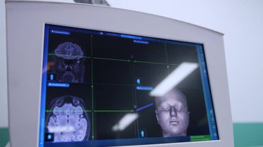 Hastanın kafasının ve beyninin 3 boyutlu görüntüsü. Beyin cerrahisinde MRI taraması yapın. Tümör ameliyatı. Kapat..