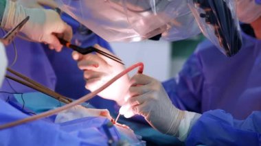 Cerrahın eldivenli eline elektrikli cerrahi alet verilir. Tanınmayan doktor mikroskop altında beyin cerrahisi yapıyor. Kapat..