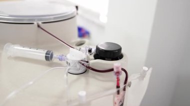 Hastanede çalışan plazma çıkarma ekipmanları. PRP konsantrasyonunun hazırlanması.
