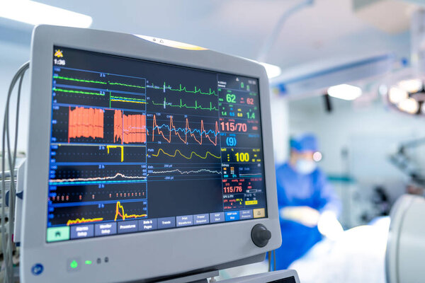 Кардиомонитор показывает признаки жизни. Монитор сердечного ритма отображает жизненные показатели во время хирургической процедуры в современной операционной.