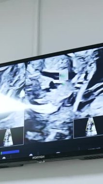 Ultrason görüntülü siyah beyaz ekran. Klinikte hamilelik kontrolü. Dikey video