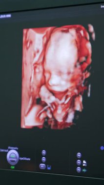 Ultrason cihazındaki sevimli bebek görüntüsü. Bir çocuğun rahim içi gelişimi. Dikey video