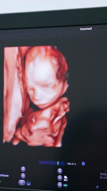 Ultrason cihazında annesinin rahmindeki bir çocuğun görüntüsü. Ultrasonik cihazlardaki bebek gelişimini kontrol ediyorum. Kapatın. Dikey video
