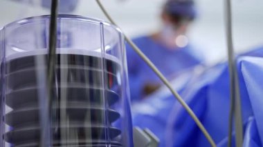 Modern akciğer havalandırma makinesinin pompası. Kapatın. Arka planda mavi üniformalı doktor var..