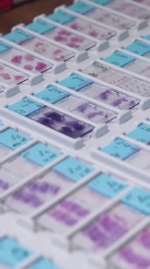 Test kanı laboratuvarı. Laboratuvarda bir sürü test örneği var. Dikey video
