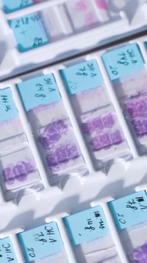 Laboratuvarda test örnekleri. Kan örneklerini özel gözlüklerle test edin. Dikey video