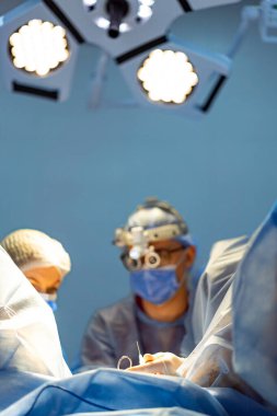 Ameliyathanede ameliyat. Cerrahlar ve çalışanlar steril bir ameliyathanede çalışırlar. Parlak ışıklar altında cerrahi bir prosedüre odaklanırlar..