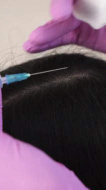 İğne mezoterapisi. Kadının kafasına kozmetik enjekte edilmiş. Kılları güçlendirmek ve büyümelerini dikey görüntülemek için itme