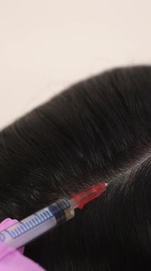 Yakışıklı bir kadın kafasına bir iğne vurulur. Mezoterapi kavramı. Saçı güçlendirmek ve büyümelerini dikey görüntülemek için itme