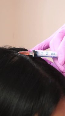 Hasta kafa enjeksiyonu yaptırıyor. Saç kaybı kavramı. Kozmetik Kliniği Dikey Video