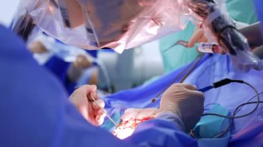 Tanınmayan cerrahın eldivenli elleri ameliyat yapıyor. Kapatın. Sinir cerrahisi mikroskop altında gerçekleştirildi.