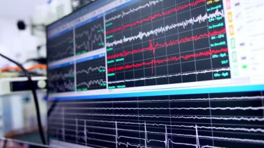 Bilgisayarın geniş ekranında çeşitli eğriler çalışır. Kapatın. Ameliyat edilen hastanın beyin dalgaları..