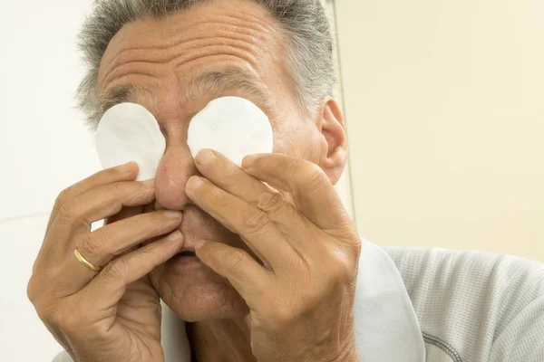Hombre Mayor Baño Usando Almohadillas Algodón Para Alivio Ocular — Foto de Stock