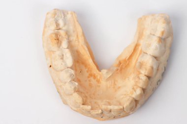 Düşük dişli bir adamın iz veya alçı kalıbına yakın durun.