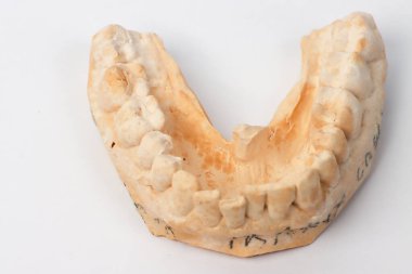 Düşük dişli bir adamın iz veya alçı kalıbına yakın durun.