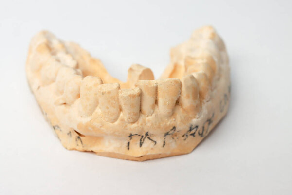 Close up of An impression or plaster mold of a mans lower teeth