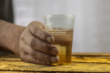 Kirli tırnakları olan ve tırnak etlerini kaldıran, beyaz arka planda viskili plastik bardak tutan erkek eller.