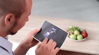 Hamilelik, genç adam baba olmaya hazırlanıyor ve evde otururken ultrasonun fotoğrafını inceliyor.