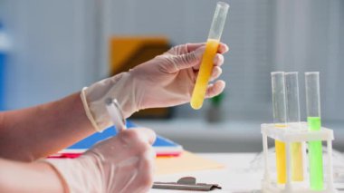 Tıbbi laboratuvar, eldivenli kadın laboratuvar asistanı test tüplerindeki çözelti reaksiyonunu inceliyor ve sonuçları not defterine, yakın çekimde yazıyor.