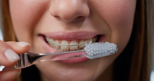 Oral Hygiene Braces - Teen Girl Cleaning Teeth