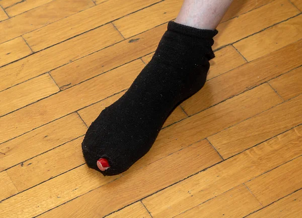 Weiblicher Fuß Zerrissener Socke Mit Abstehendem Großen Zeh — Stockfoto