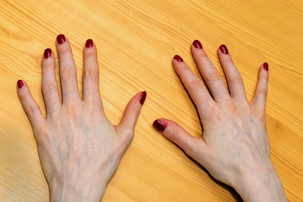 Eleganckie Czyste Kobiece Dłonie Manicure Paznokcie Malowane Czerwonym Lakierem Paznokci — Zdjęcie stockowe