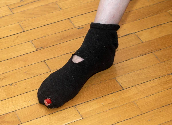 Zerstörte Alte Socke Auf Frauenfuß Mit Herausragendem Zeh — Stockfoto
