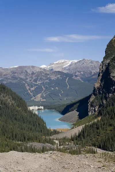 Lake Louise Banff National Park Alberta Canada — Stock Photo, Image