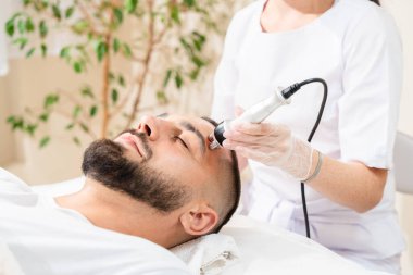 Radyo frekansı kaldırma, hasta erkekler için RF kaldırma tedavisi olarak bilinir.