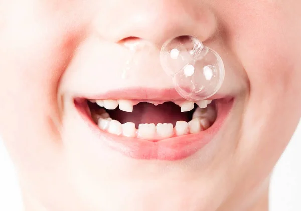Children\'s cold. Children\'s runny nose known as baby snot. Funny big bubble of snot from child nose.