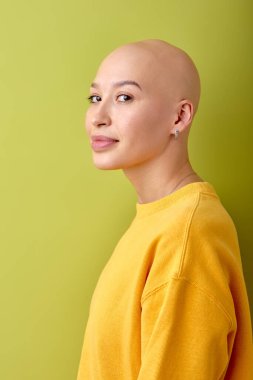 Portrait of hairless bald caucasian female in yellow shirt posing at camera, side view. attractive european lady looking calm and pretty, beautiful, look at camera. youth, alopecia, oncology, people