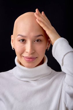Close-up portrait of positive smiling bald female in casual wear posing looking at camera. Attractive lady with allopecia or cancer enjoy life, having good mood, no reason to feel bad, touching head