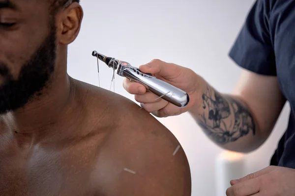 cropped doctor sticks needles into black male body on the acupuncture, using device. unrecognizable skilled professional doctor treating male client, needles on back spine shoulders.