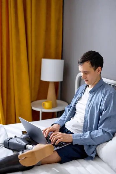 Concentrated Young Man Prosthesis Legs Using Laptop Remote Job Home — Stock Photo, Image