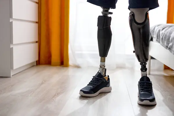 handicapped young unrecognizable man with leg prosthesis in sneakers standing indoors at home, cropped photo. modern leg prosthesis