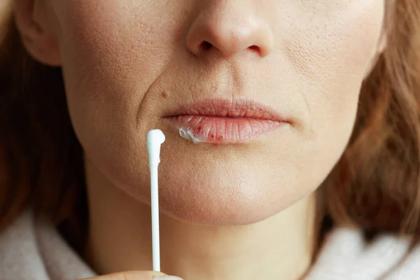 Closeup Woman Herpes Lips Applying Ointment Using Cotton Swab Beige — Stockfoto