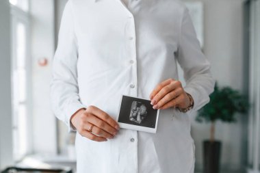 Beyaz önlüklü kadın elinde bebek fotoğrafı tutuyor..