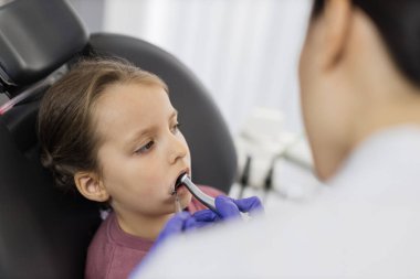 Genç bayan doktor dişlerini tedavi ederken dişçi koltuğunda uzanmış dişlerini matkapla tedavi ederken küçük şirin bir kızın üst açı görüntüsü. Taşıyıcı önleme ve tedavi. Çocuk diş sağlığı ocağında.