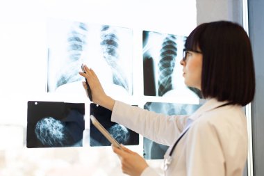 Doktor hastane ortamında göğüs röntgenlerini ve mammogramlarını inceliyor. Radyografik görüntüleri incelemek, teşhis ve hasta bakımına odaklanmak için ışık kutusunu kullanan tıp uzmanı..