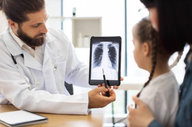 Beyaz erkek doktor akciğer röntgenini klinikte genç beyaz bir kızla birlikte inceledi. Beyaz önlüklü doktor, tıbbi detayları özenli çocuğa açıklamaya odaklanmış..