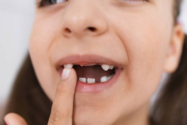 Küçük beyaz kız evinde dişini kaybetmiş, mutlu bir şekilde gülümsüyor. Bebek dişini tutan çocuk, doğal dönüm noktasını heyecan ve neşeyle kutluyor..